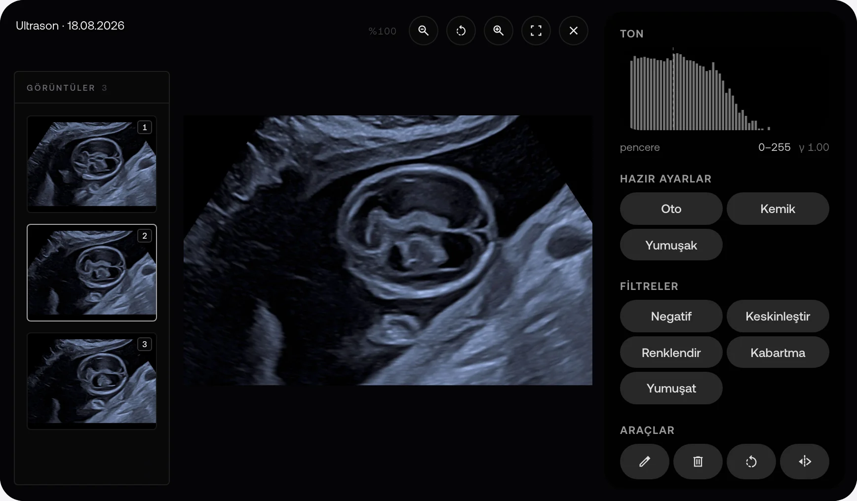 MyKlinik görüntüleyicisinde örnek fetal ultrason